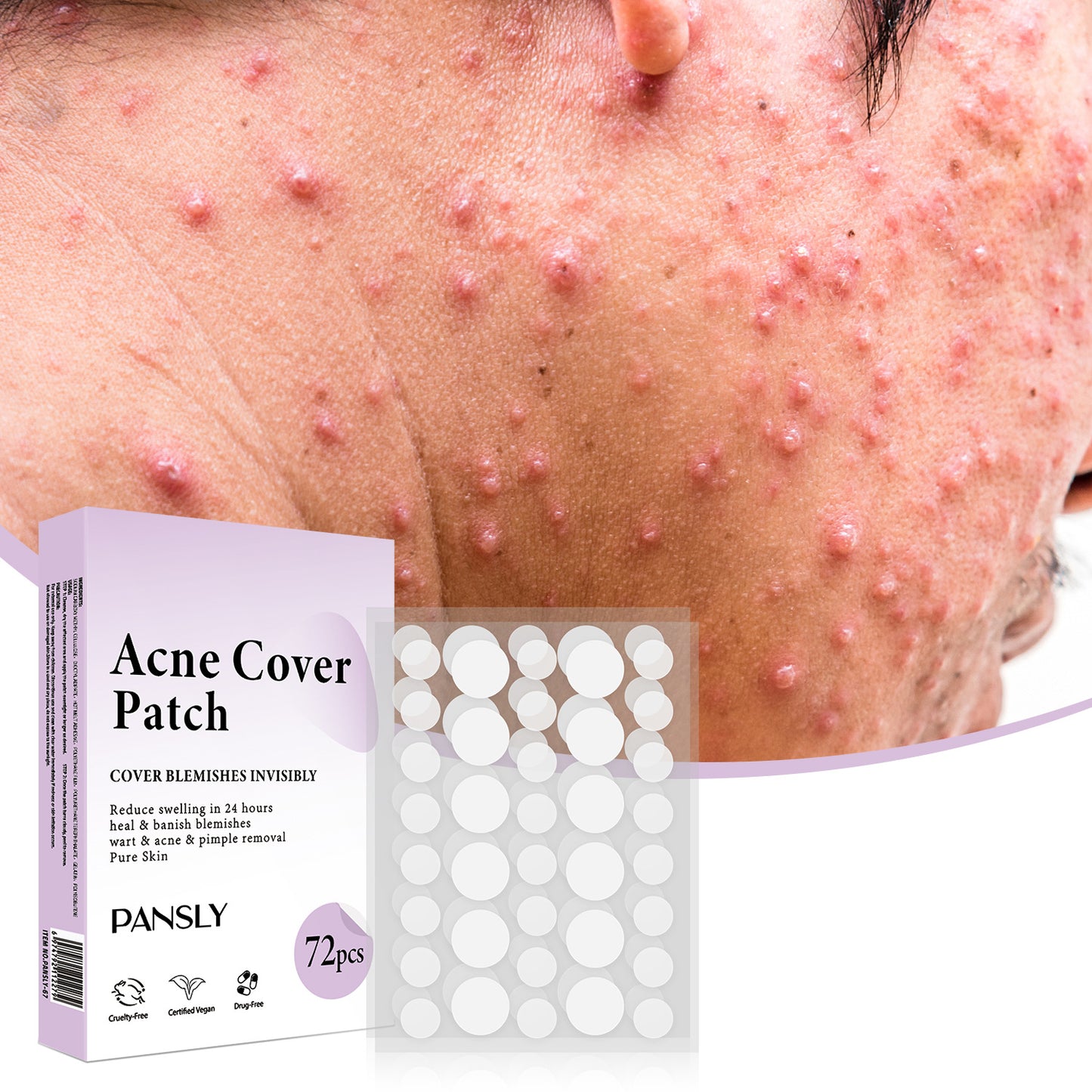 Smallpox Diluting Skin Care Patch