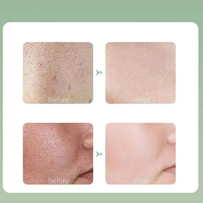 Deep Cleansing Mask (4g×12pcs/Box)  (Available)