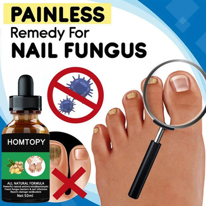 Efficient Nail Repair Solution Treating Cracked Discolored Nails Gray Foot Care Toe Nail Sterilization Nourishing Essence Uñas