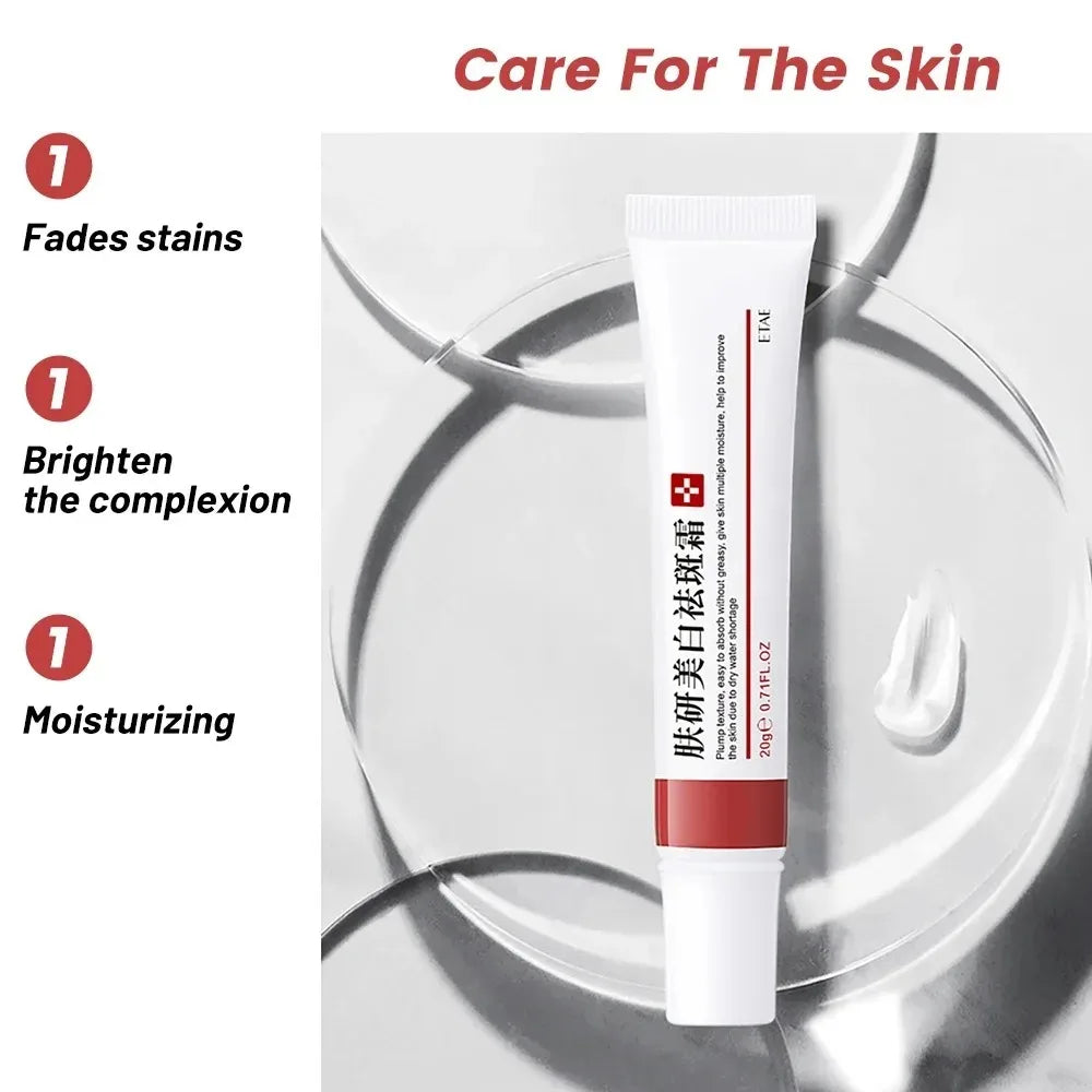 Whitening Freckle Cream Niacinamide Remove Dark Spot Cream Anti Freckle and Aging Cream Fade Pigmentation Melasma Skin