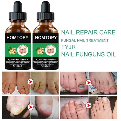 Efficient Nail Repair Solution Treating Cracked Discolored Nails Gray Foot Care Toe Nail Sterilization Nourishing Essence Uñas