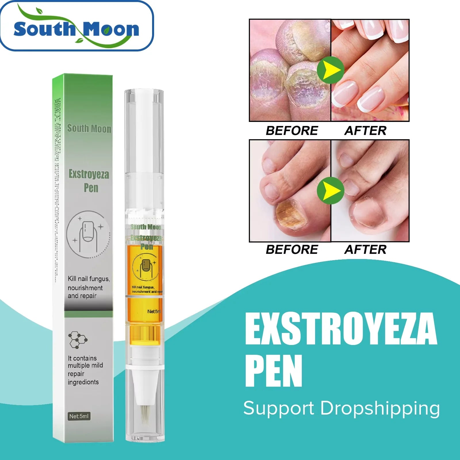 South Moon Nail Fungus Repair Pen Remove Onychomycosis Paronychia Redu ...