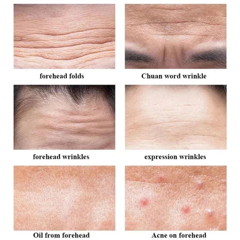 New Anti-wrinkle Forehead Line Removal Gel Patch Firming Mask Frown Treatment Stickers Anti-aging Moisturizng Face Skin Care
