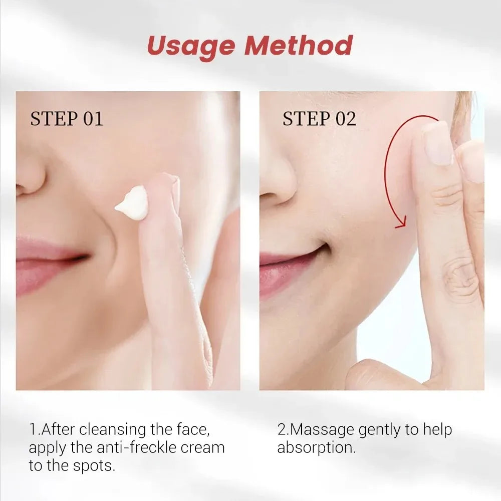 Whitening Freckle Cream Niacinamide Remove Dark Spot Cream Anti Freckle and Aging Cream Fade Pigmentation Melasma Skin