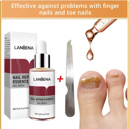15mlFungus Care Remove Onychomycosis Toes Nourish Brighten Hands Feet Product Repair Suitable Women Nail Pepair Essencs