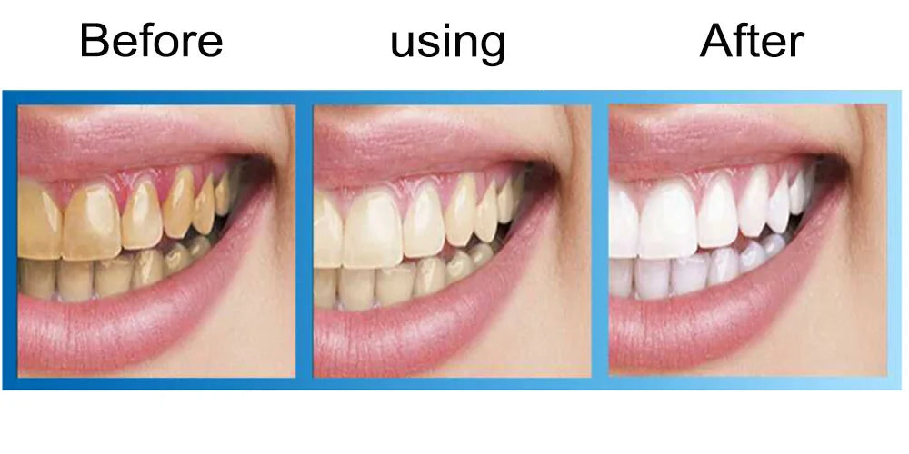 Whitening teeth Remove yellow , black spots, stains,  whitening essence powder, dental instruments, beauty liquid