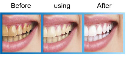 Whitening teeth Remove yellow , black spots, stains,  whitening essence powder, dental instruments, beauty liquid