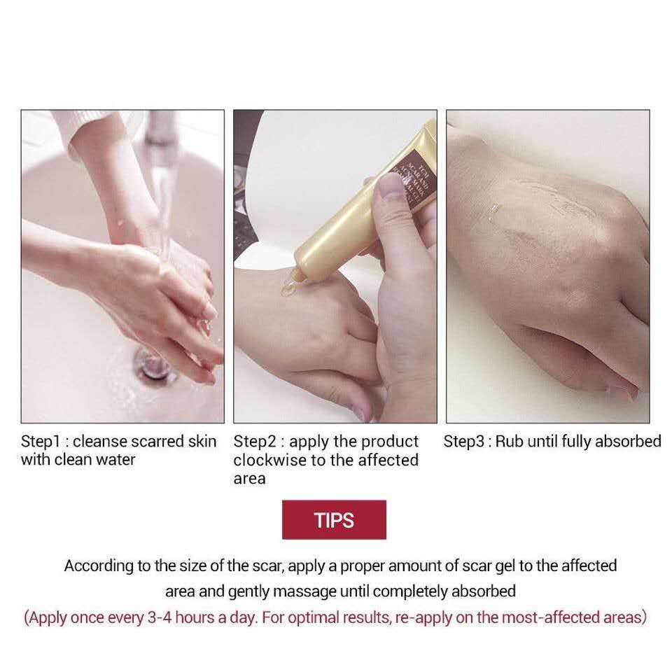 TCM Scar Acne Mark Removal Gel Ointment, 30g  (Available)