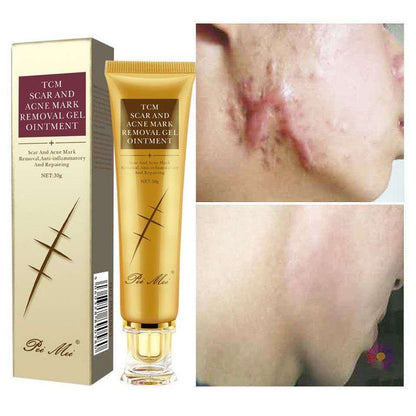 TCM Scar Acne Mark Removal Gel Ointment, 30g  (Available)