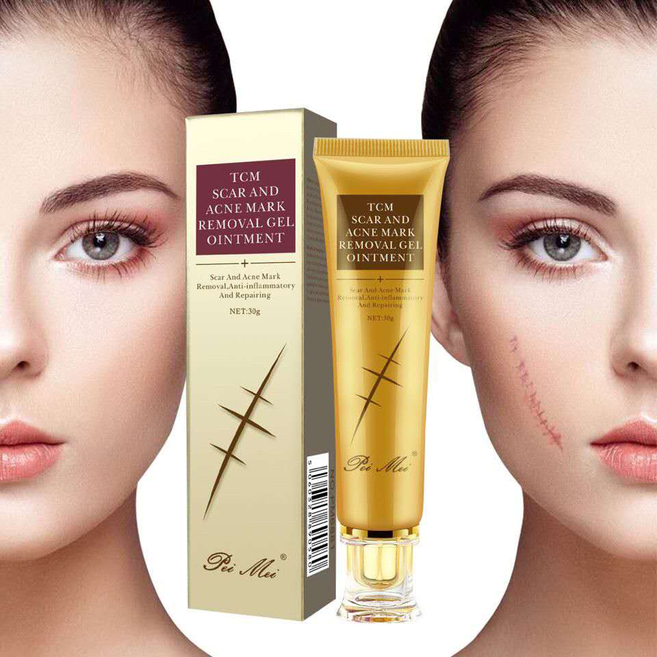 TCM Scar Acne Mark Removal Gel Ointment, 30g  (Available)