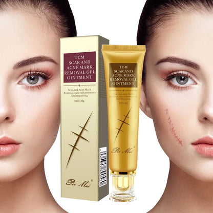 TCM Scar Acne Mark Removal Gel Ointment, 30g  (Available)
