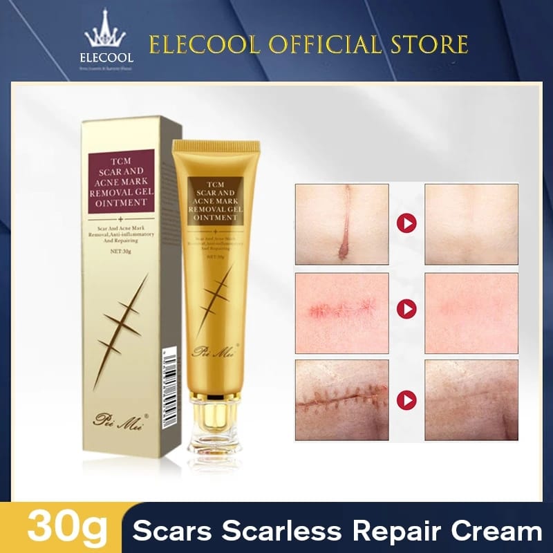 TCM Scar Acne Mark Removal Gel Ointment, 30g  (Available)
