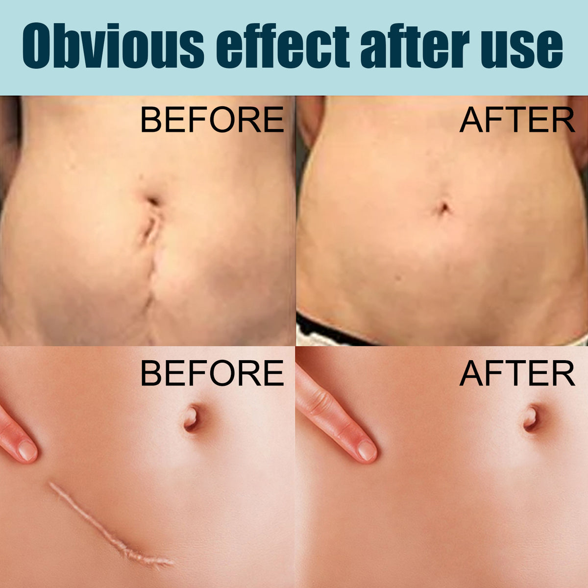 Skin Repair Gel Mild Care