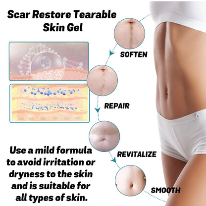 Skin Thinning Scar Care Gel